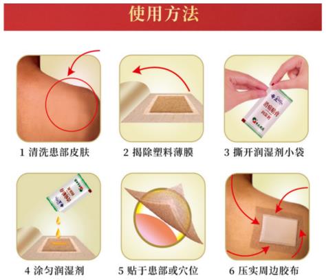 奇正消痛貼膏可以治手腕扭傷嗎？