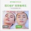 青春期臉上長痘痘怎么調理?