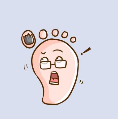 腳上有灰指甲是什么原因呢？