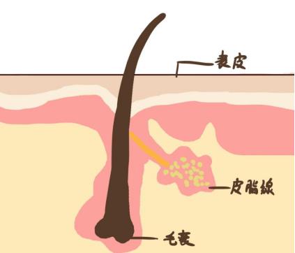 去黑頭粉刺的有效方法是什么？