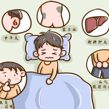 孩子背部蒙古斑是怎么形成的，是黏多糖貯積癥2型嗎