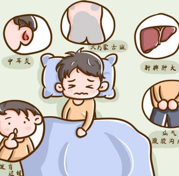小兒肩關節活動受限怎么辦，是MPS2嗎