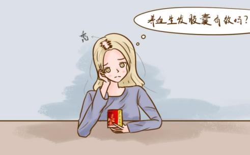 吃養血生發膠囊能治掉頭發嗎