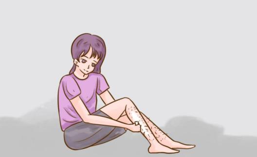 夏天來臨，腿毛長怎么辦