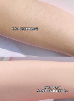 夏天來臨，腿毛長怎么辦