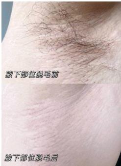 薇婷脫毛膏用完有氨臭是真的嗎？