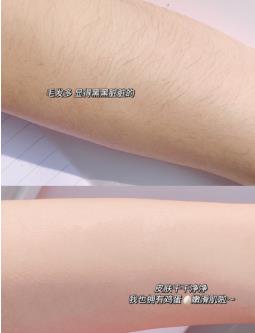 為什么薇婷脫毛膏受到大家歡迎