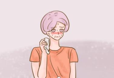 絕經后婦女頭上愛出汗怎么辦