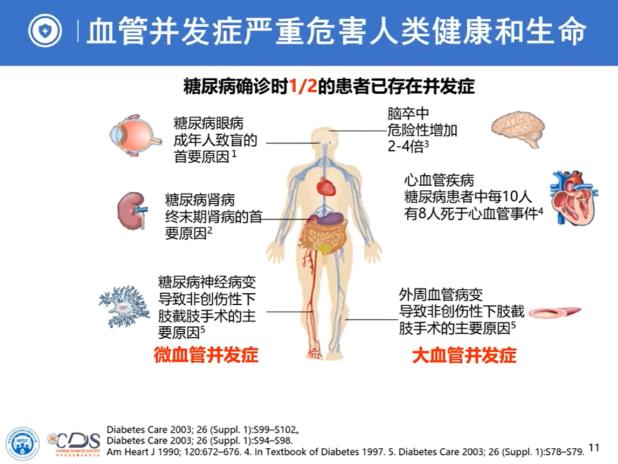 專家權威解讀｜糖尿病并發癥——隱藏在糖尿病背后的“殺手”