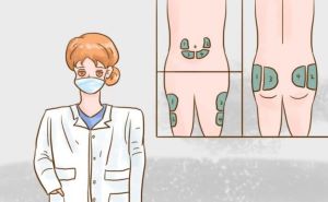 關于糖尿病人注射胰島素部位圖及注意項，你知道嗎？