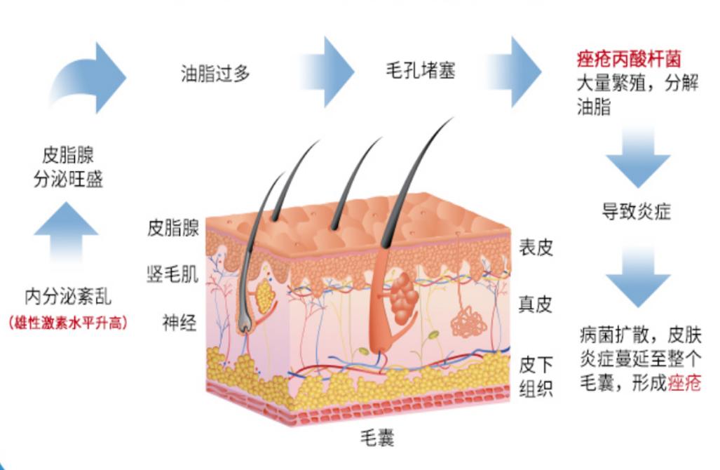 毛囊炎引起的細菌感染怎么辦