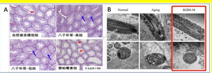 男人擺脫腎精虧虛，八子補腎膠囊怎么服用效果好