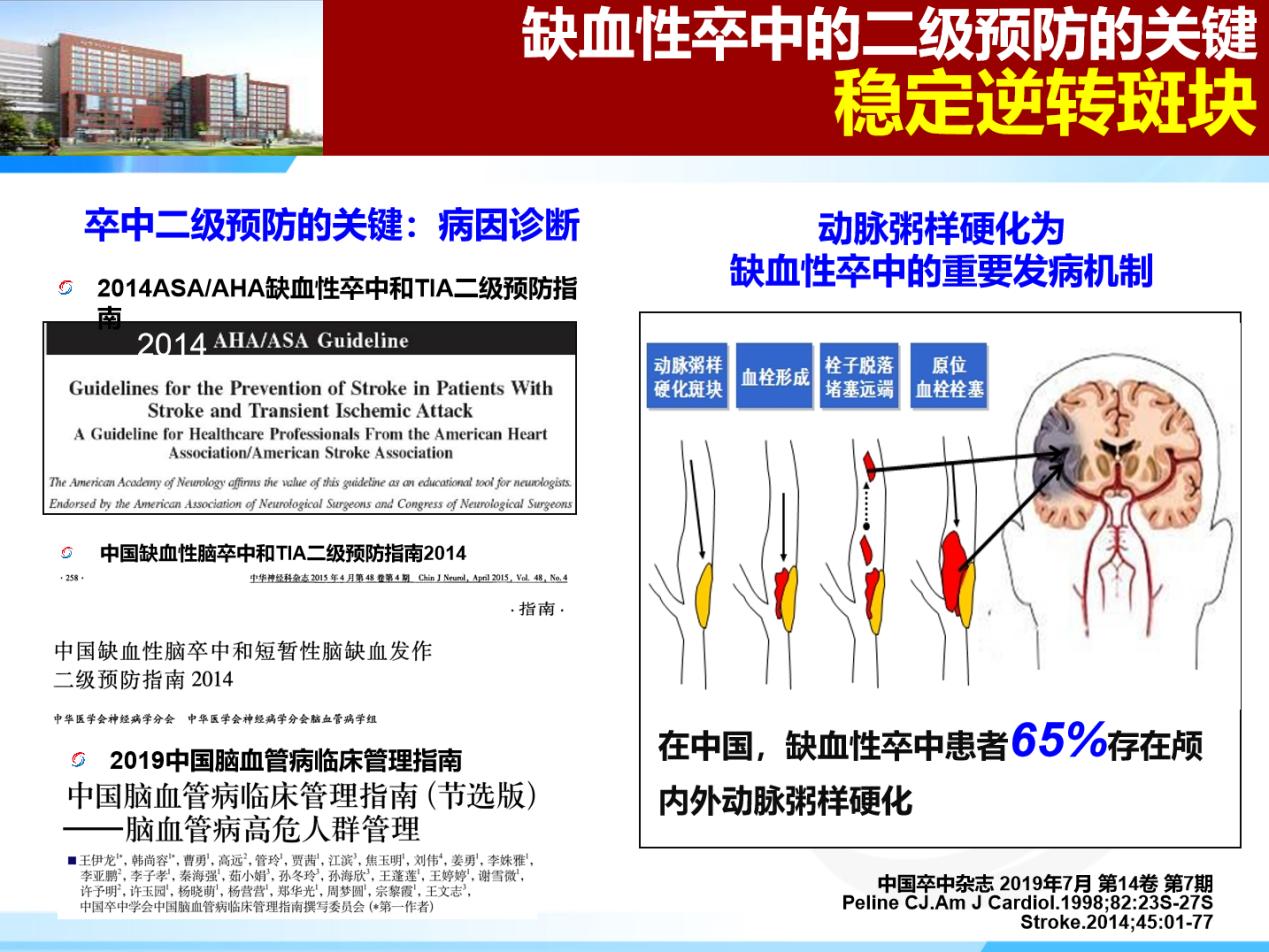 干預動脈粥樣硬化進展，做好卒中的二級預防