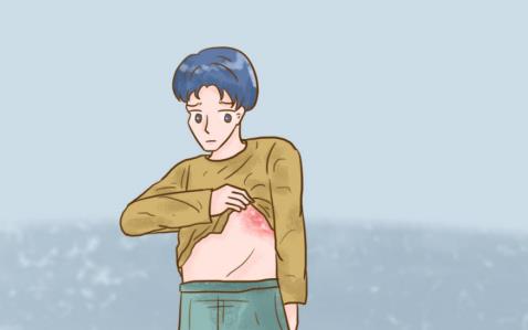 帶狀皰疹后神經痛常用藥物你知道嗎？