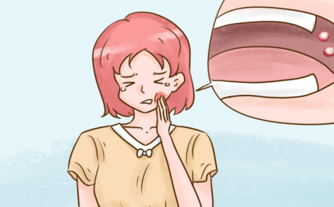 口腔潰瘍白色創面用什么藥好？寧之助幫您解決！