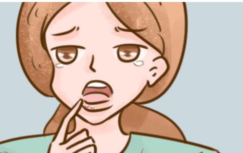 口炎型口瘡是復發性口腔潰瘍嗎？這些你還不知道嗎？