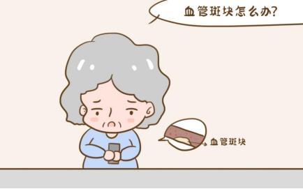 動脈血管斑塊怎么消除？做對這幾件事很重要