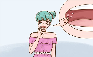 你還不知道口腔潰瘍用什么藥治療？意可貼值得您選擇！