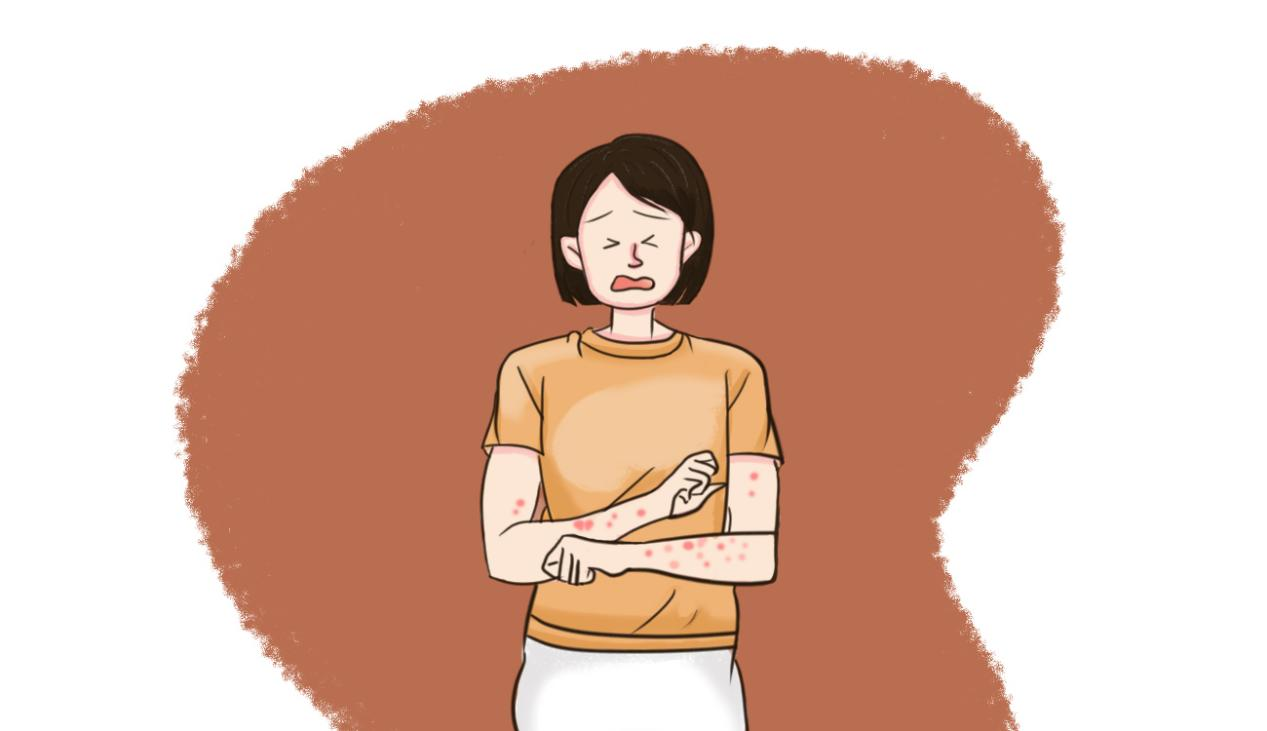癢死了！被跳蚤咬了怎么消腫止癢最快