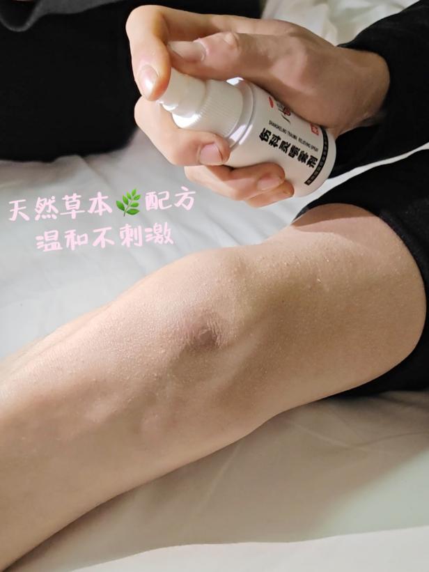 軟組織挫傷多久能消腫，如何加快恢復