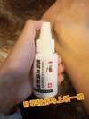 腳踝嚴重扭傷發紅怎么解決