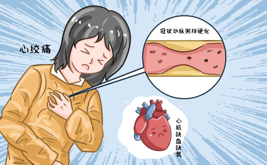 速效救心丸于心絞痛防治的必要性：患有心絞痛是否需常備？