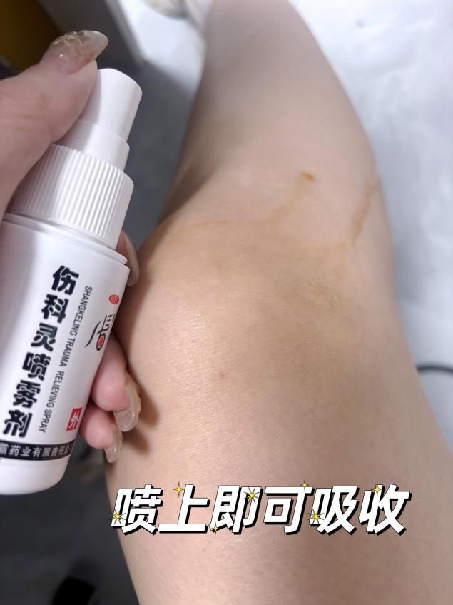 小腿挫傷多久能恢復(fù)，用什么藥更好