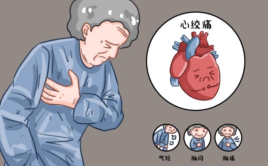 空調(diào)房VS戶外高溫，溫差易致血管痙攣！心絞痛患者注意